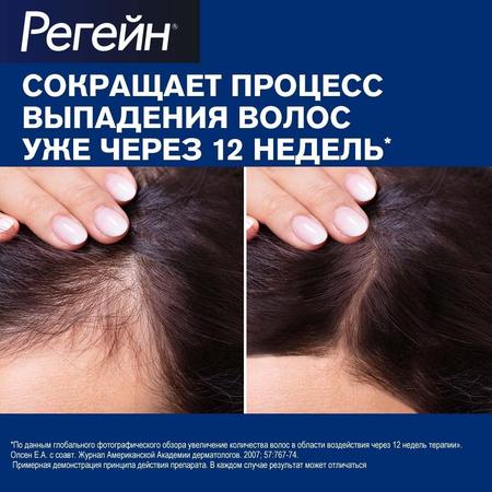 Фото Регейн, пена 5%, 60 г, 3 шт.