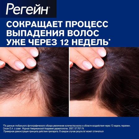 Фото Регейн, пена 5%, 60 г, 3 шт.