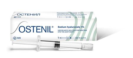 Фото Остенил, имплантат для внутрисуставных инъекций 20 мг/2 мл, шприц 2 мл, 1 шт.