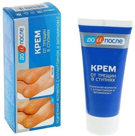 Фото До и После, крем от трещин в ступнях, 50 мл