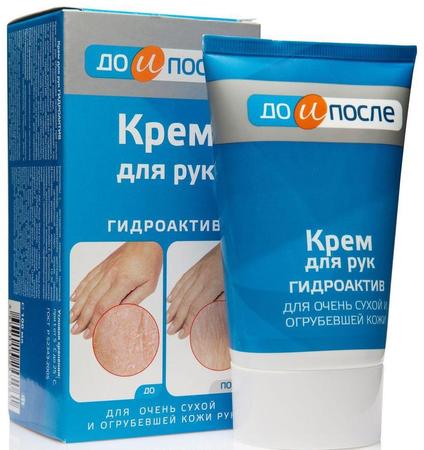 Фото До и После Гидроактив, крем для сухой кожи рук, 100 мл