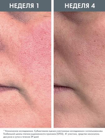 Фото Avene Antirougeurs Rosamed, концентрат для кожи склонной к покраснениям, 30 мл